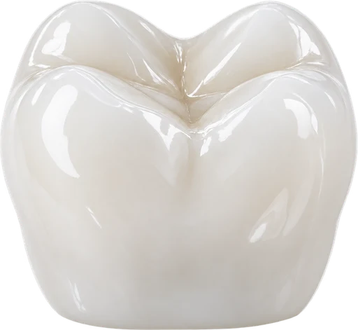 Illustration of an implant crown